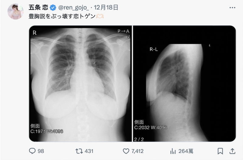 TSE最胸战士！五条恋(五条恋)不是一片限定！