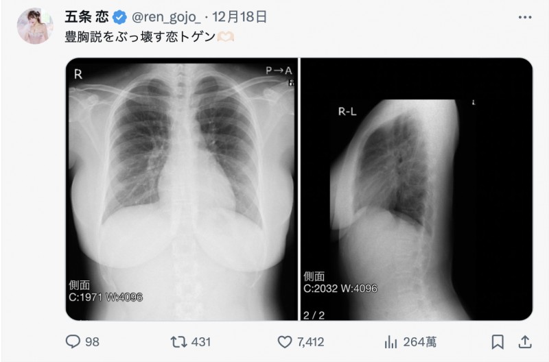 TSE最胸战士！五条恋不是一片限定！