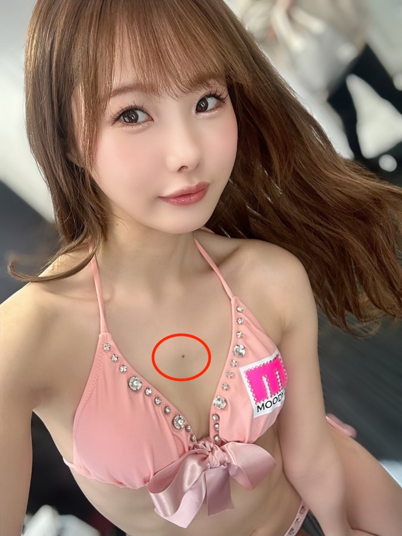 松本いちか(松本一香)：这两个地方的痣别修掉！